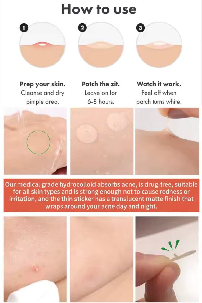 Hydrocolloid Acne Patch