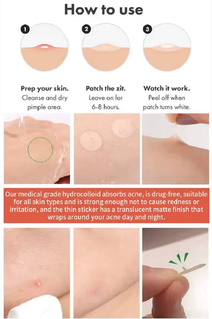 Hydrocolloid Acne Patch