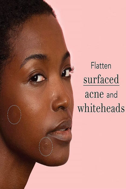 Hydrocolloid Acne Patch