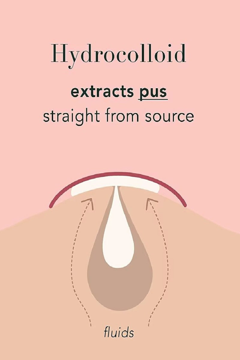 Hydrocolloid Acne Patch