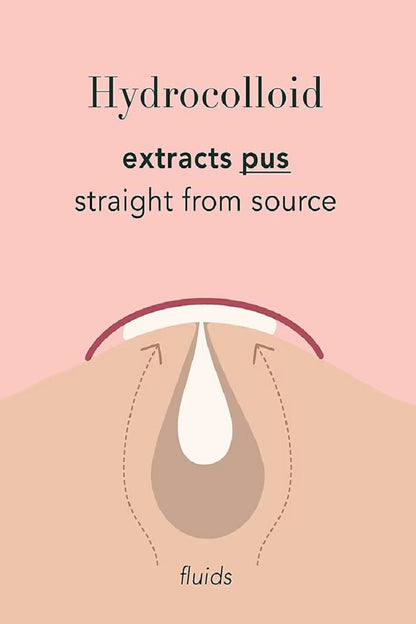 Hydrocolloid Acne Patch